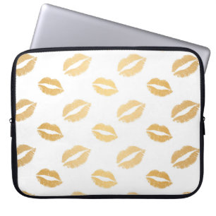 Glanzende Kusjes Laptop Sleeve