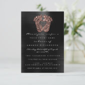 Glitter Baby shower Feet Roos Skin Black Kaart (Staand voorkant)
