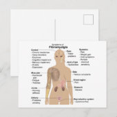 Grafiek Gemeenschappelijke tekenen en symptomen va Briefkaart (Voorkant / Achterkant)