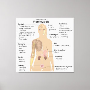 Grafiek Tekenen Symptomen Fibromyalgie Canvas Prin
