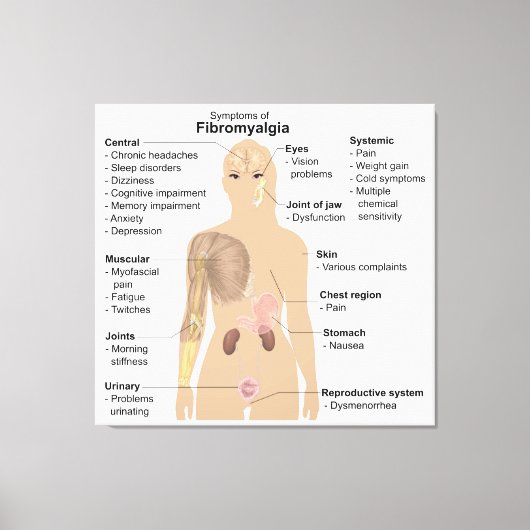 Grafiek Tekenen Symptomen Fibromyalgie Canvas Prin (Voorkant)