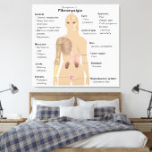 Grafiek Tekenen Symptomen Fibromyalgie Canvas Prin (Insitu (Slaapkamer))