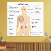 Grafiek Tekenen Symptomen Fibromyalgie Canvas Prin (Insitu (Woonkamer))