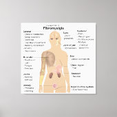 Grafiek Tekenen Symptomen Fibromyalgie Canvas Prin Afdruk (Voorkant)