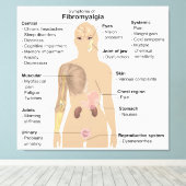 Grafiek Tekenen Symptomen Fibromyalgie Canvas Prin Afdruk (Insitu (Houten vloer))