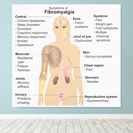 Grafiek Tekenen Symptomen Fibromyalgie Canvas Prin Afdruk (Insitu (Houten vloer))