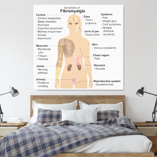 Grafiek Tekenen Symptomen Fibromyalgie Canvas Prin Afdruk (Insitu (Slaapkamer))