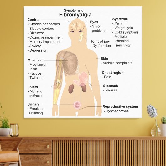 Grafiek Tekenen Symptomen Fibromyalgie Canvas Prin Afdruk (Insitu (Woonkamer))