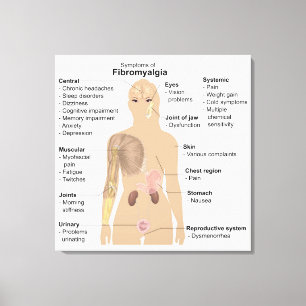 Grafiek Tekenen Symptomen Fibromyalgie Canvasprint Canvas Afdruk