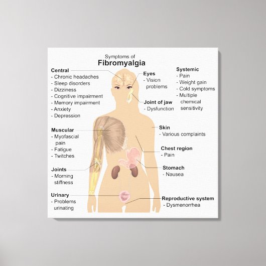 Grafiek Tekenen Symptomen Fibromyalgie Canvasprint Canvas Afdruk (Voorkant)