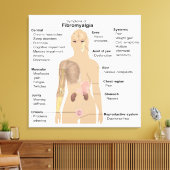 Grafiek Tekenen Symptomen Fibromyalgie Canvasprint Canvas Afdruk (Insitu (Woonkamer))