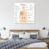 Grafiek Tekenen Symptomen Fibromyalgie Canvasprint Canvas Afdruk (Insitu (Slaapkamer))