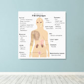 Grafiek Tekenen Symptomen Fibromyalgie Canvasprint Canvas Afdruk (Insitu (Houten vloer))
