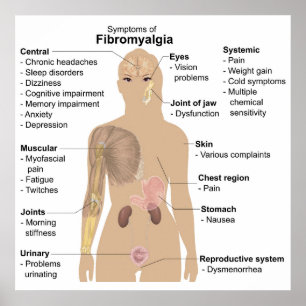 Grafiek Vaak Tekenen + Symptomen Fibromyalgie Post Poster