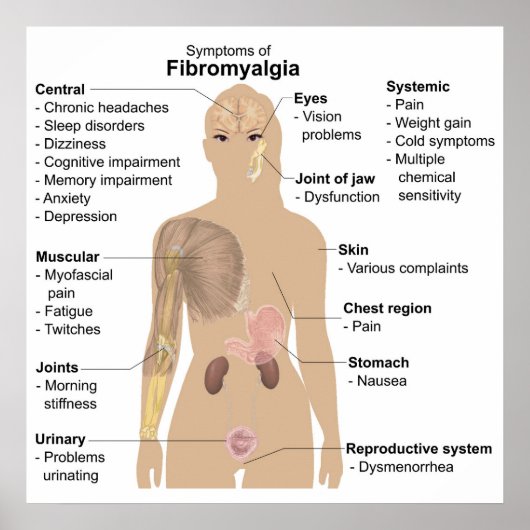 Grafiek Vaak Tekenen + Symptomen Fibromyalgie Post Poster (Voorkant)