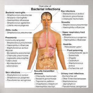 Grafiek van de belangrijkste bacteriële infecties  poster