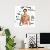 Grafiek van de belangrijkste symptomen van koperve poster (Thuiskantoor)