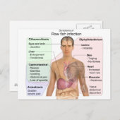 Grafiek van de symptomen van de ruwe visinfectie briefkaart (Voorkant / Achterkant)