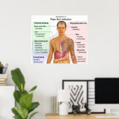 Grafiek van de symptomen van een ruwe visinfectie poster (Thuiskantoor)