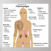 Grafiek van de symptomen van fibromyalgie poster (Voorkant)