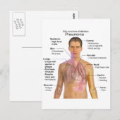 Grafiek van de symptomen van pneumonie briefkaart (Voorkant / Achterkant)