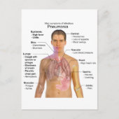 Grafiek van de symptomen van pneumonie briefkaart (Voorkant)