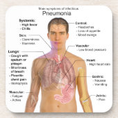Grafiek van de symptomen van pneumonie onderzetter (Voorkant)