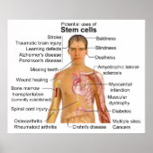 Grafiek van het potentiële gebruik voor stamcelbeh poster (Voorkant)