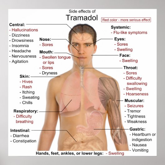 Grafiek voor bijwerkingen van tramadol hydrochlori poster (Voorkant)