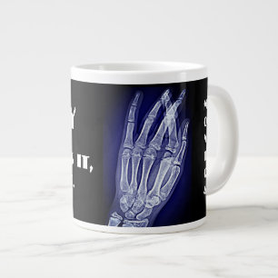 Grappig"röntgenfoto. Als je het breekt, neem ik h Grote Koffiekop
