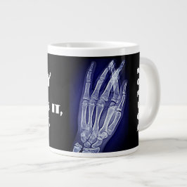 Grappig"röntgenfoto. Als je het breekt, neem ik he Grote Koffiekop