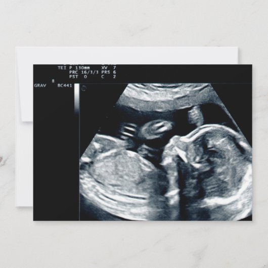 Grappig schattig avocado ultrasone fotozwangerscha aankondiging (Achterkant)