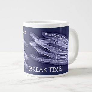 Grappige gebroken vinger röntgenfoto "Pauze" Grote Koffiekop