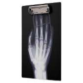 Grappige Hand X-ray Voor internet verslaafde Klembord (Links)