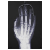 Grappige Hand X-ray Voor internet verslaafde Klembord (Achterkant)