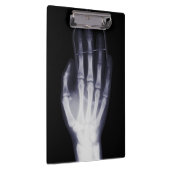 Grappige Hand X-ray Voor internet verslaafde Klembord (Rechts)