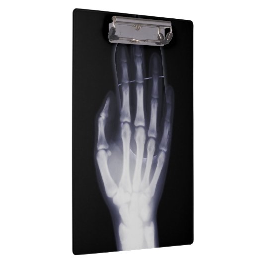 Grappige Hand X-ray Voor internet verslaafde Klembord (Rechts)