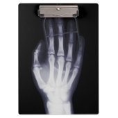 Grappige Hand X-ray Voor internet verslaafde Klembord (Voorkant)