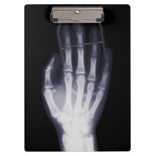 Grappige Hand X-ray Voor internet verslaafde Klembord