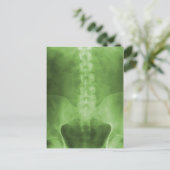 Green Digital X-Ray Art-Briefkaarten Briefkaart (Staand voorkant)