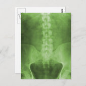 Green Digital X-Ray Art-Briefkaarten Briefkaart (Voorkant / Achterkant)