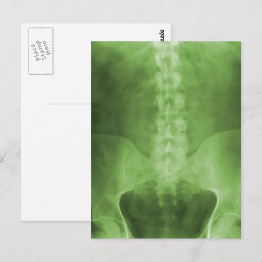 Green Digital X-Ray Art-Briefkaarten Briefkaart (Voorkant / Achterkant)