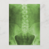 Green Digital X-Ray Art-Briefkaarten Briefkaart (Voorkant)