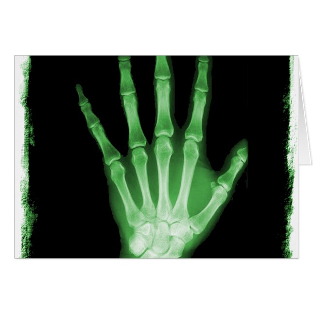 Green X-ray Skeleton Hand (Voorkant Horizontaal)