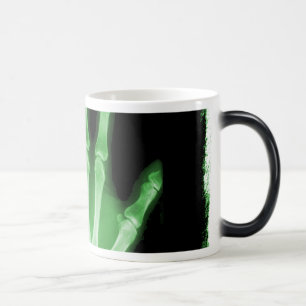 Green X-ray Skeleton Hand Magische Mok