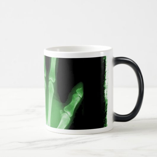 Green X-ray Skeleton Hand Magische Mok (Rechts)