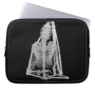 Griezelig gotisch vleermuis skelet laptop sleeve