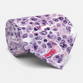 Grootcellymfoom Stropdas (Opgerold)