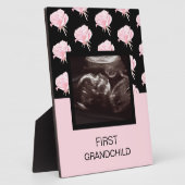 Grootonderliggende roze Ultrasound bij het eerste  Fotoplaat (Zijkant)