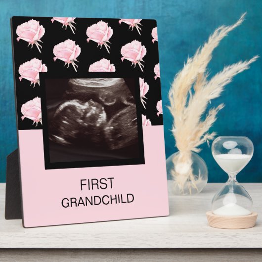 Grootonderliggende roze Ultrasound bij het eerste  Fotoplaat (Zijkant)
